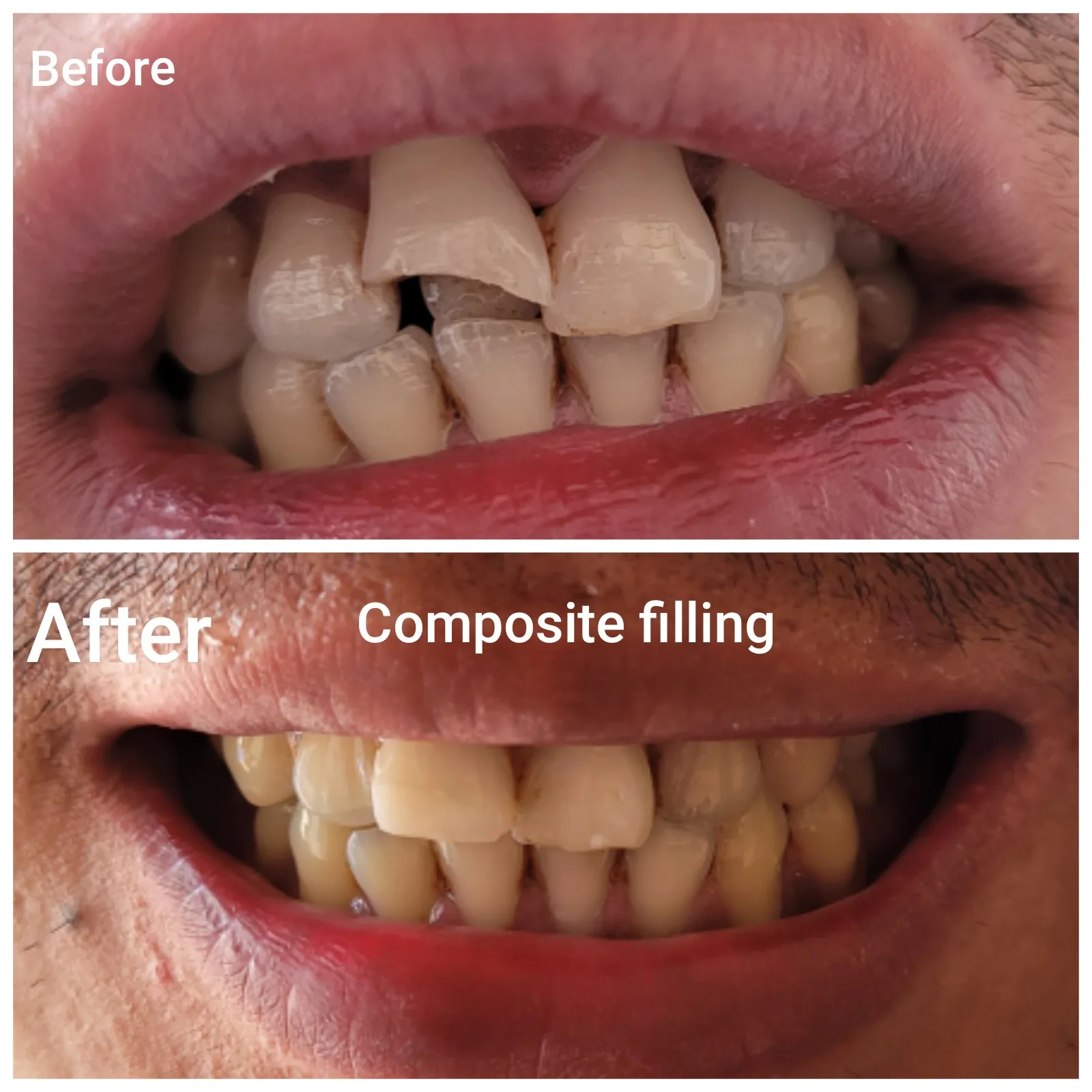 Treatment Result
